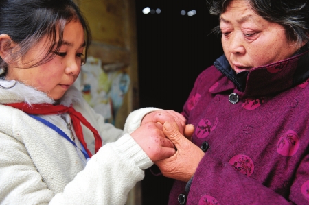 王登玉經常做家務,奶奶心疼地撫摸孫女被凍壞的小手。